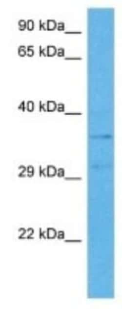 Melanocortin-3 R/MC3R Rabbit anti-Human, Polyclonal, Novus Biologicals 100 &mu;g | Buy Online | Novus Biologicals | Fisher Scientific